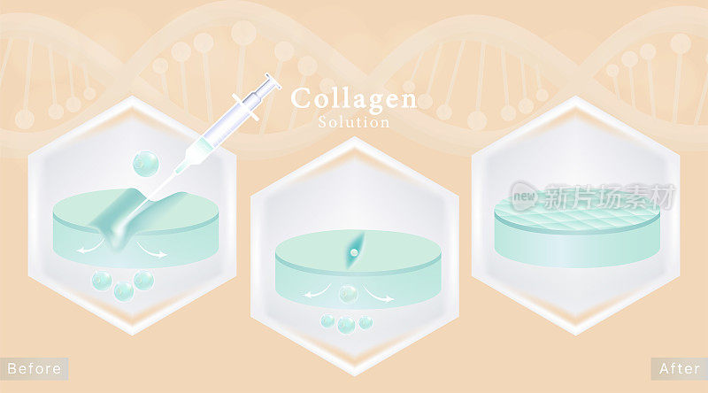 Hyaluronic acid before and after skin solutions ad, blue collagen injection with cosmetic advertising background ready to use, illustration vector.